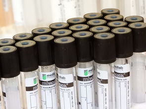 科技期刊，科学进步的催化剂